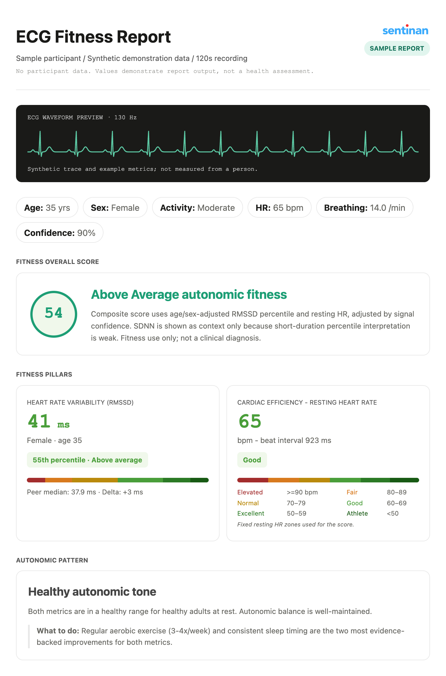 Waveform and recording details from the sample report